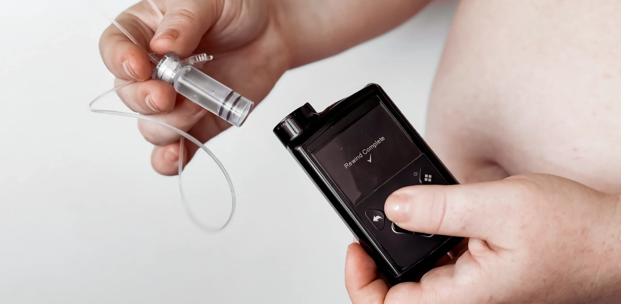 Diyabet Hemşirelik Eğitimi